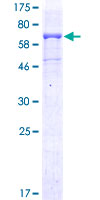 12.5% SDS-PAGE Stained with Coomassie Blue.